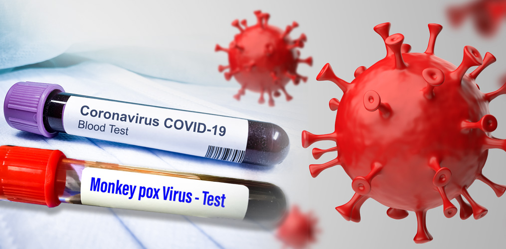 هل تساعد جائحة "كورونا" الدول على تجنُّب تفاقم "جدري القرود"؟