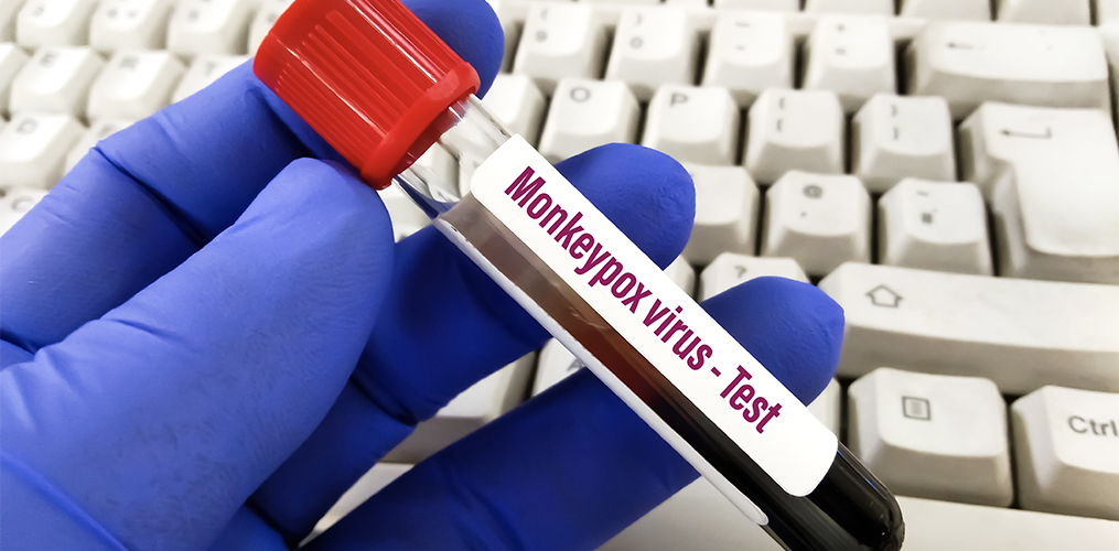 Is Monkeypox the Next Pandemic?